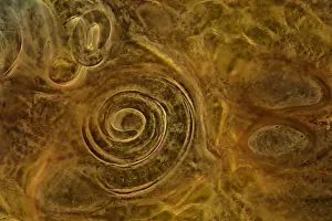 Spirals: Trichinella spiralis encysted in pork muscle