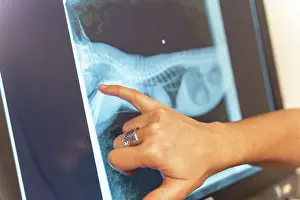 Control: Veterinary clinic, veterinarian reviewing the x-ray